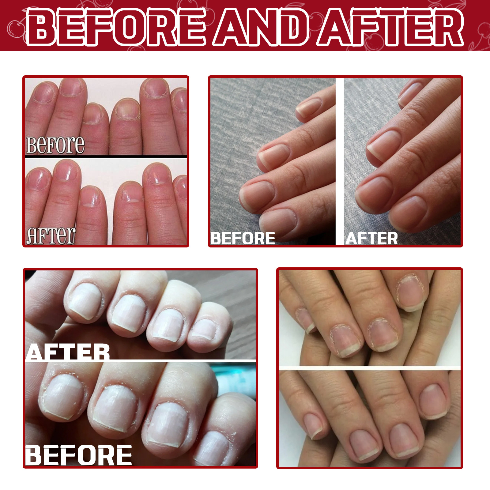 Cuticle Oil Eliminating Keratin Strengthen Nail Angular Layer Moisturizing Nail Edge Armor Oil Chapped Nail Skin Repair Serum Natural Nail Treatment