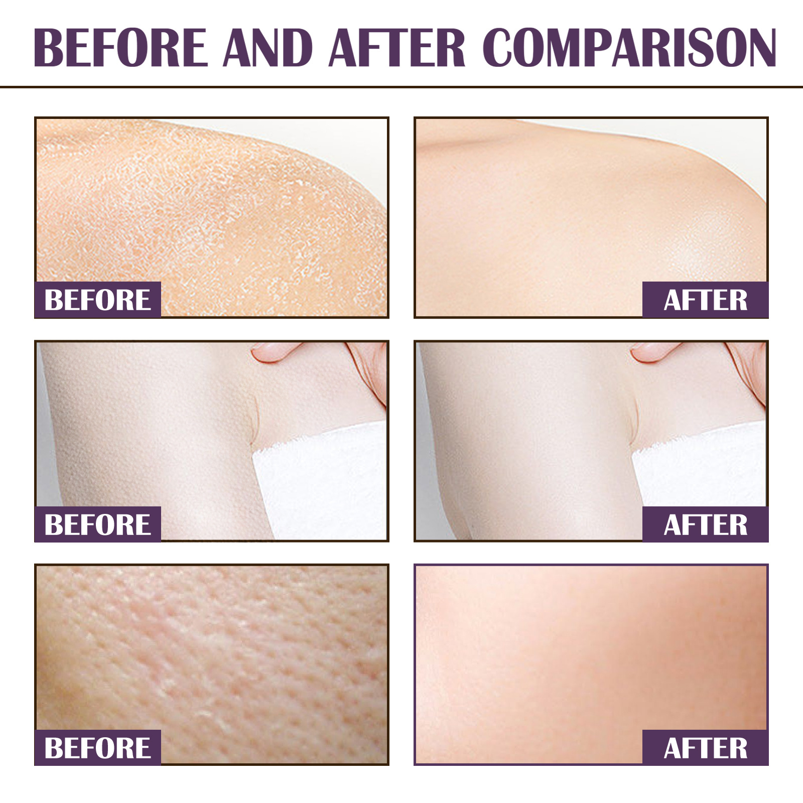 Nicotinamide Body Scrub Body Wash Body Cleansing Dead Skin Body Care For Women