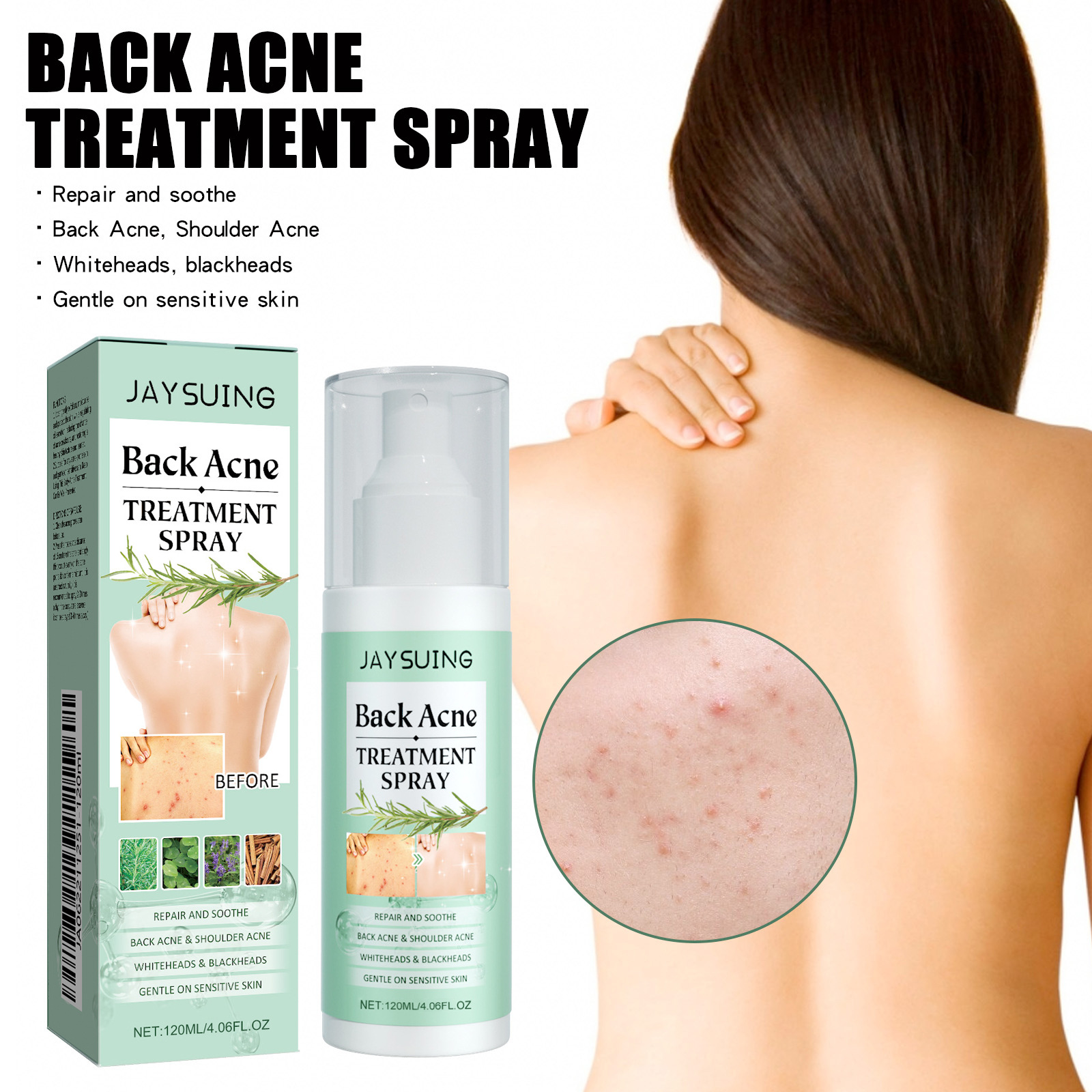 (1 PC) Back Care Spray Back Acne Remover Spray Shoulder Pimple Repair Whiteheads Treatment Blackhead Anti Mites Oil Control Hydrate Body Soothing Serum