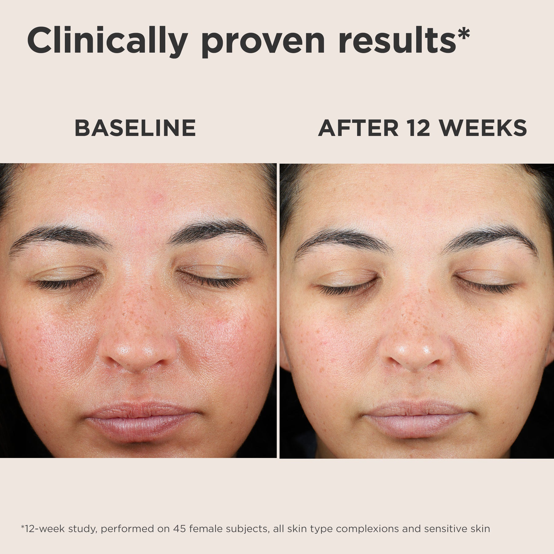 EltaMD Green Tint Sunscreen UV Skin Recovery Red Color Correcting Green Tint Broad Spectrum SPF 50 1.7 oz / 48g