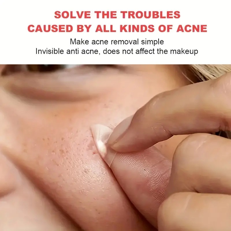 Hydrocolloid Acne Patches Cover Zits Blemishes Anti Pimple Invisible Healing Spot Stickers Waterproof Breathable Patches Women Men Face Skin Care