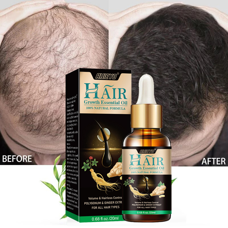 Hair Growth Essential Oil Ginger Hair Lost Solution Serums Fast Scalp Hair Care Treatment For Men Women 20ml