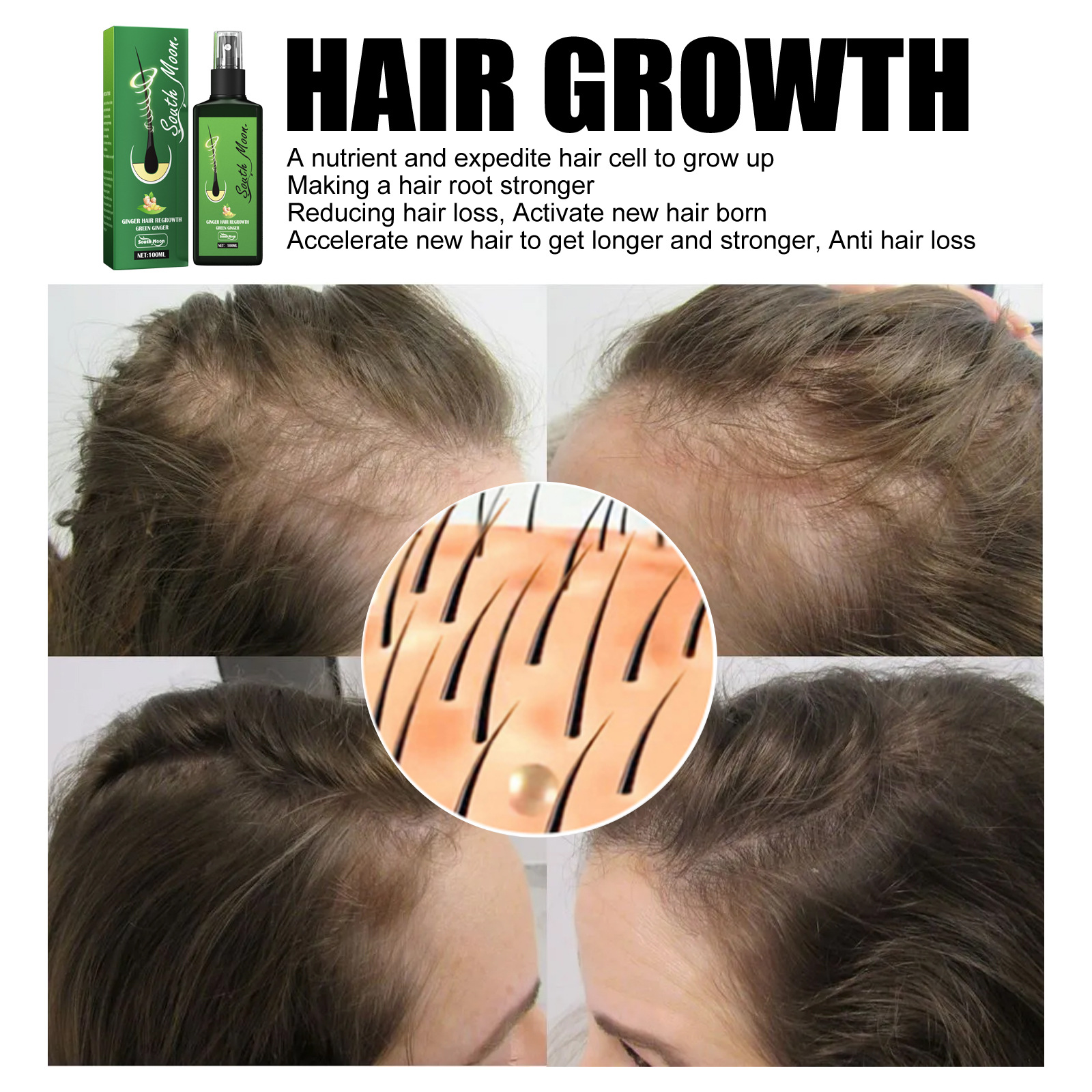 Hair Lotion Serum Essence Nourishing Ginger Spray Liquid Organic Growth Hair Growth Hydrating Anti Hair Loss Treatment for Men Women