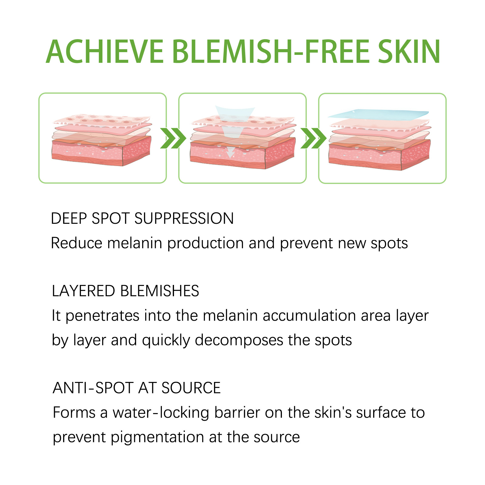 Whitening Freckles Cream Face Remove Melasma Dark Spots Lighten Melanin Melasma Remover Moisturizing Brighten Skin Care 30ml