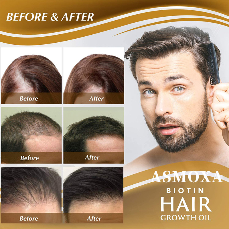 Hair Growth Essential Oil Hair Strengthening Oil Vitamin B7 Anti Hair Loss Woman Mild Care Head Scalp Nourishing Root Moisturizing Serum Hair Care 35ml