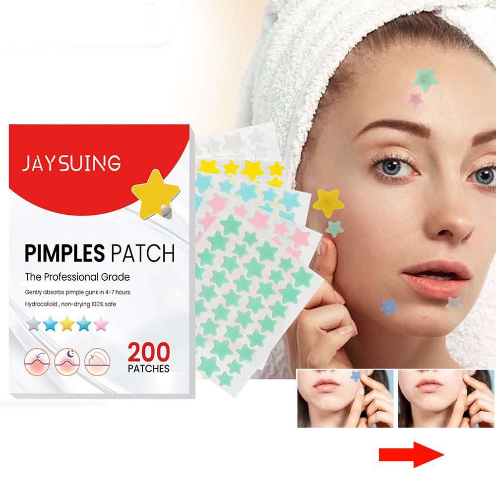 (star) Star Pimple Patch 200pcs Set Acne Invisible Acne Removal Stickers Acne Treatment Pimple Remover Concealer Face Spot Beauty Face Skin Care Makeup Tools