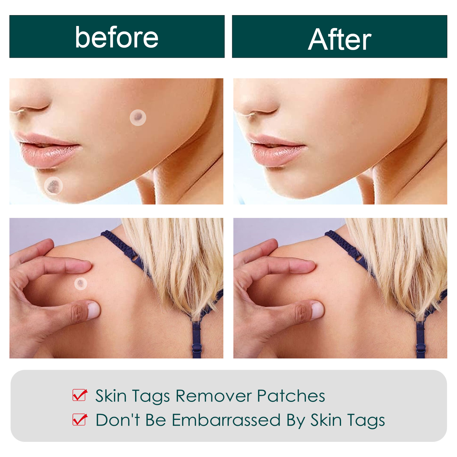 Skin Tag Patches Mole Wart Remover Skin Care Removal 144pcs Patches Kit Fast and Easy Operate Skin Home Removal Tool Face and Neck Repair Daily Care