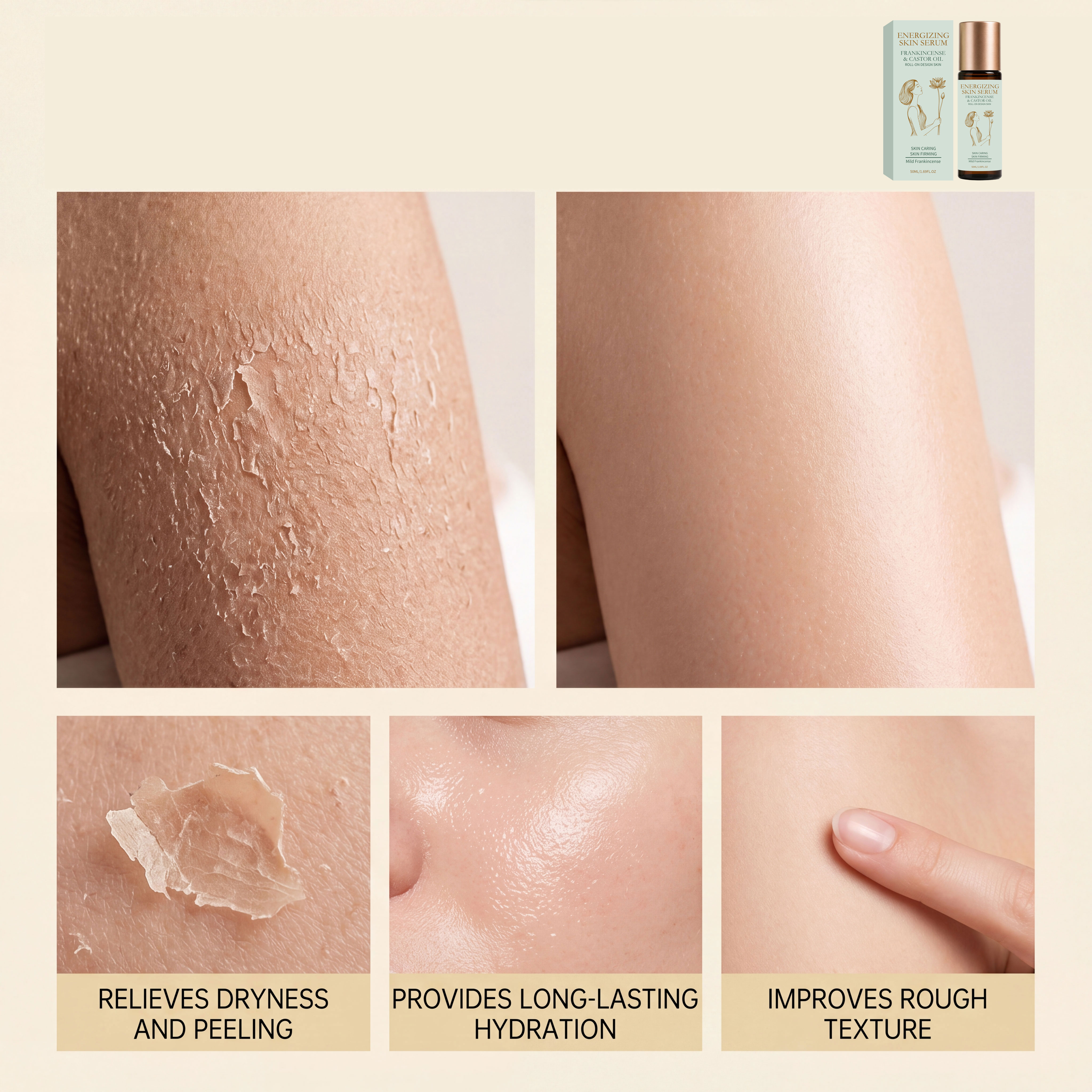 Skin Brightening Frankincense Essence Oil Moisturizing Hydrating Soft Rolling Ball Design Body All Over Usable Care Liquid