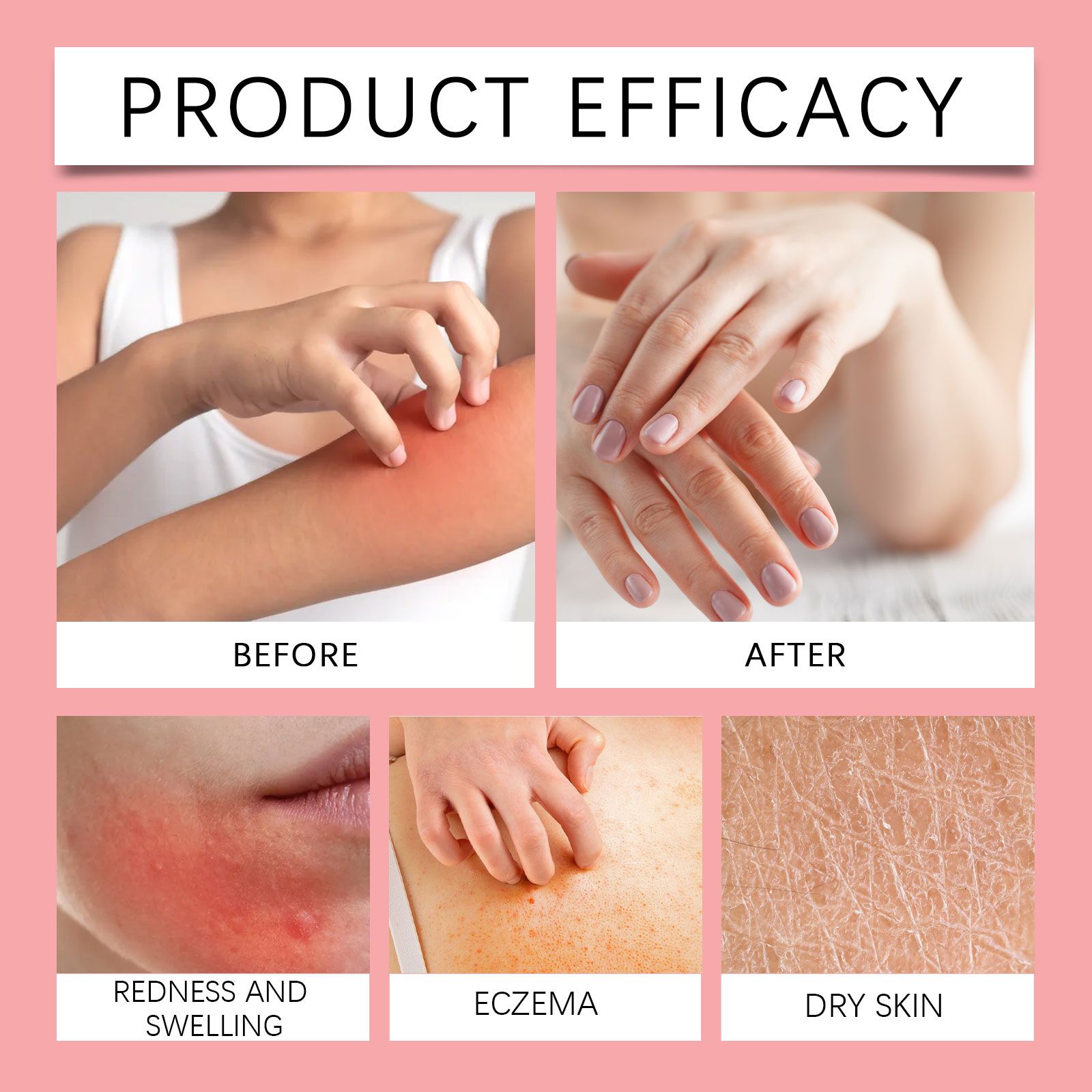 Local Cleansing Ointment Mild Ingredients Clean Body Skin Tender Moisturizing Daily Massage Smear Lotion