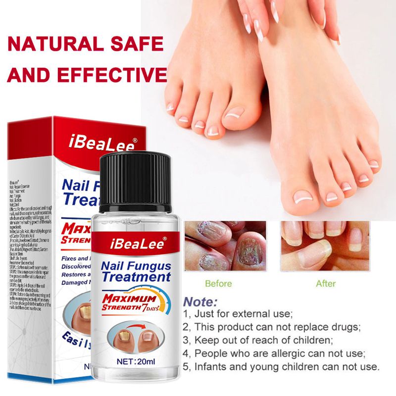 iBeaLee Nail Fungus Treatment Natural Safe And Effective Nail Repair Liquid