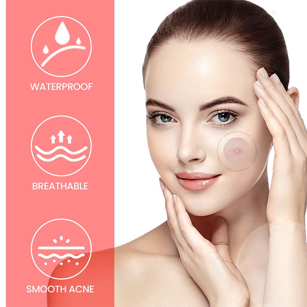 (star) Star Pimple Patch 200pcs Set Acne Invisible Acne Removal Stickers Acne Treatment Pimple Remover Concealer Face Spot Beauty Face Skin Care Makeup Tools