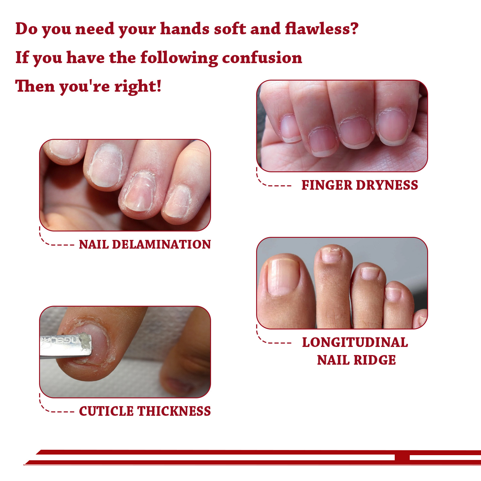Cuticle Oil Eliminating Keratin Strengthen Nail Angular Layer Moisturizing Nail Edge Armor Oil Chapped Nail Skin Repair Serum Natural Nail Treatment