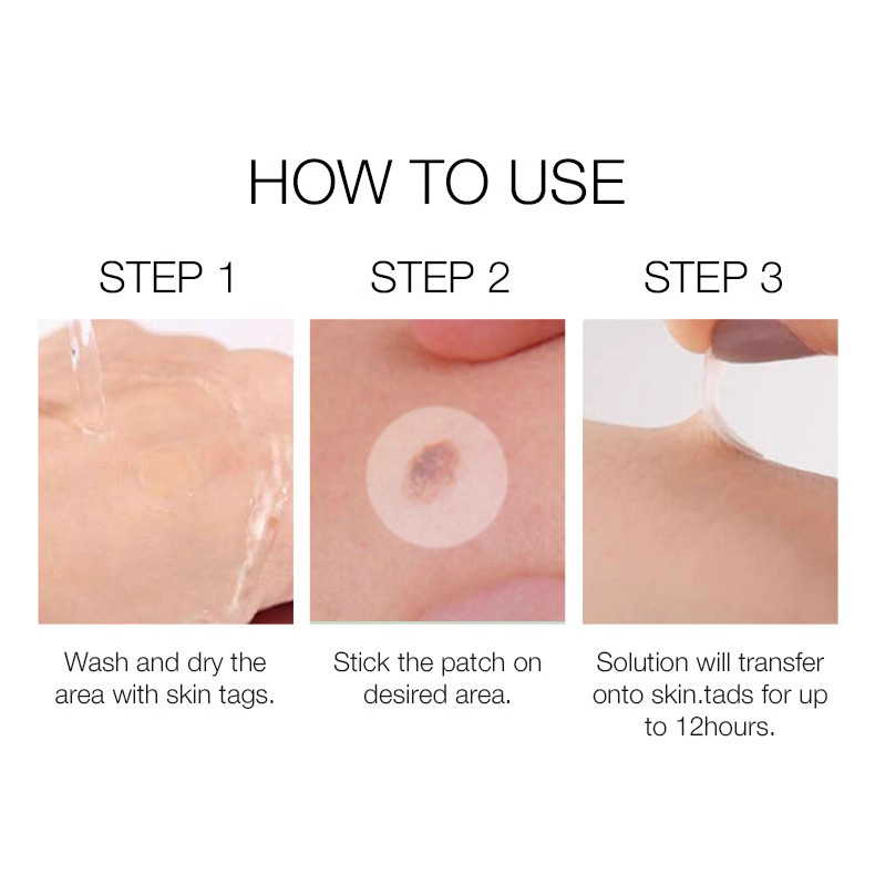 Skin Tag And Pimple Removal Patches For Face Gentle Covering Soothing Blemish And Skin Tag Daily Care