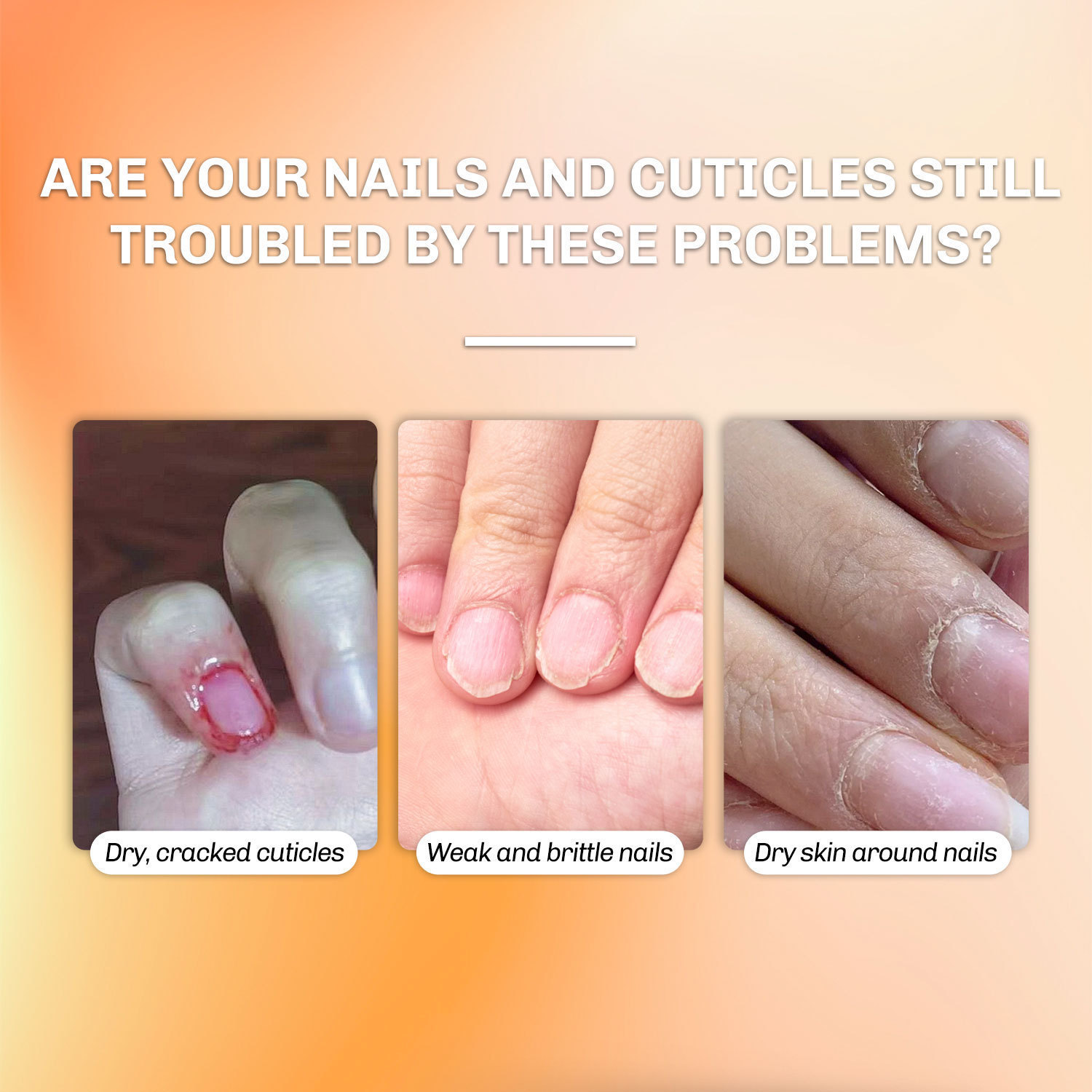 Nail Cuticle Oil Strengthening Repairing For Dry Rough Cuticles Daily Nail Care