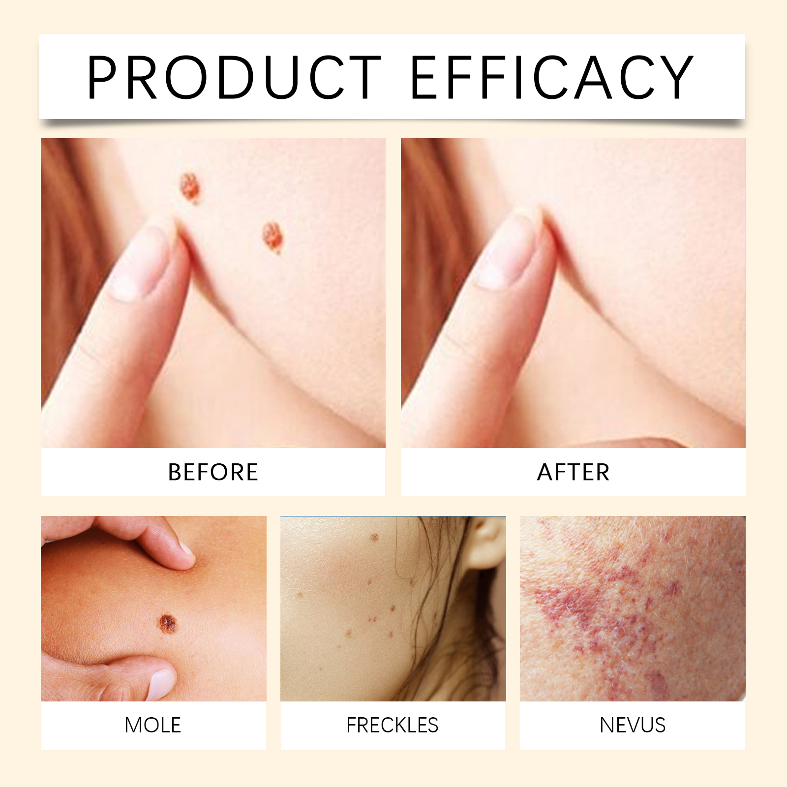 Bee Venom Skin Care Spray Mild Formula Cleanses Nourishes Gentle Care Refreshes Skin Tender Protection