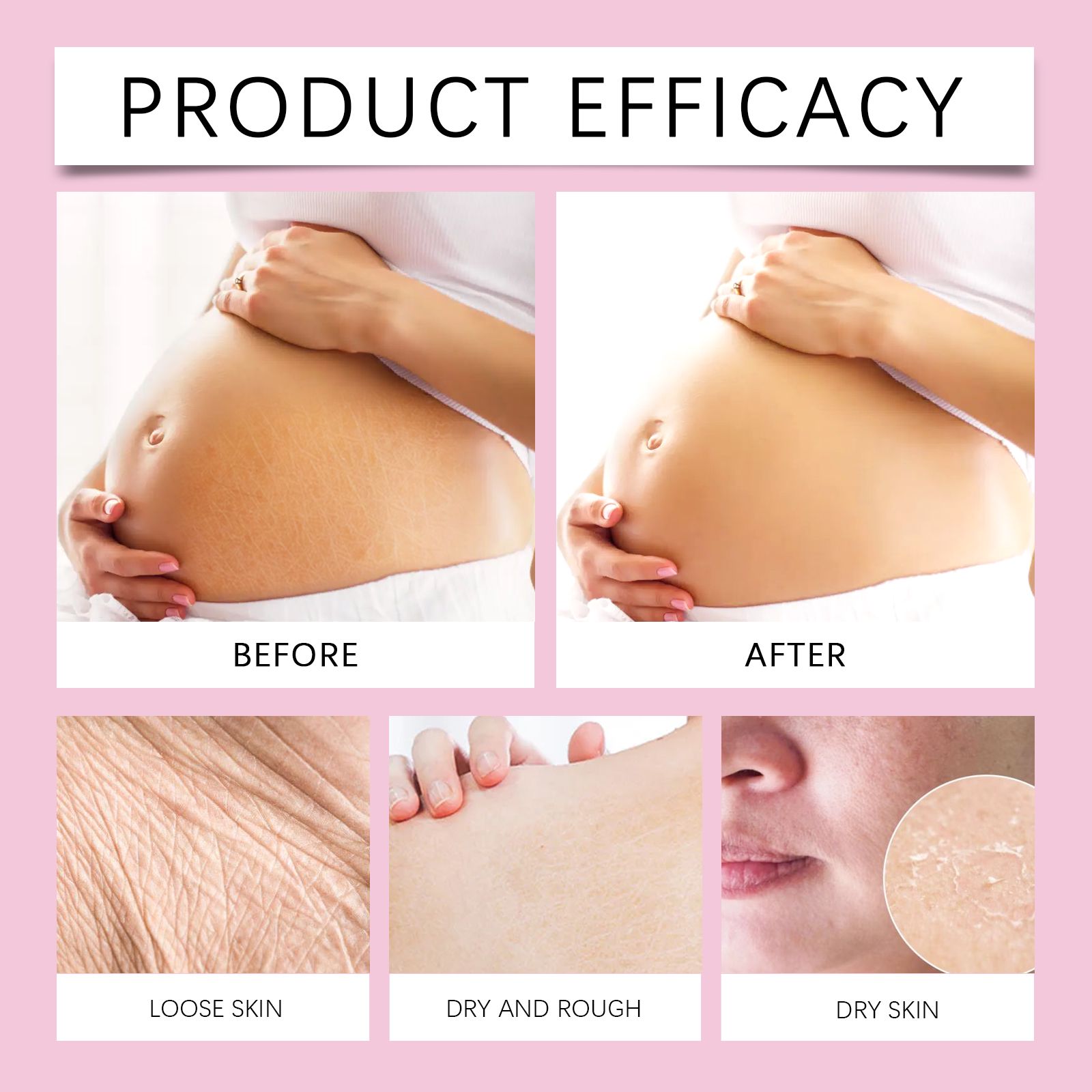 Body Skin Care Set With Grape Seed Coconut And Shea Butter For Stretch Mark Care