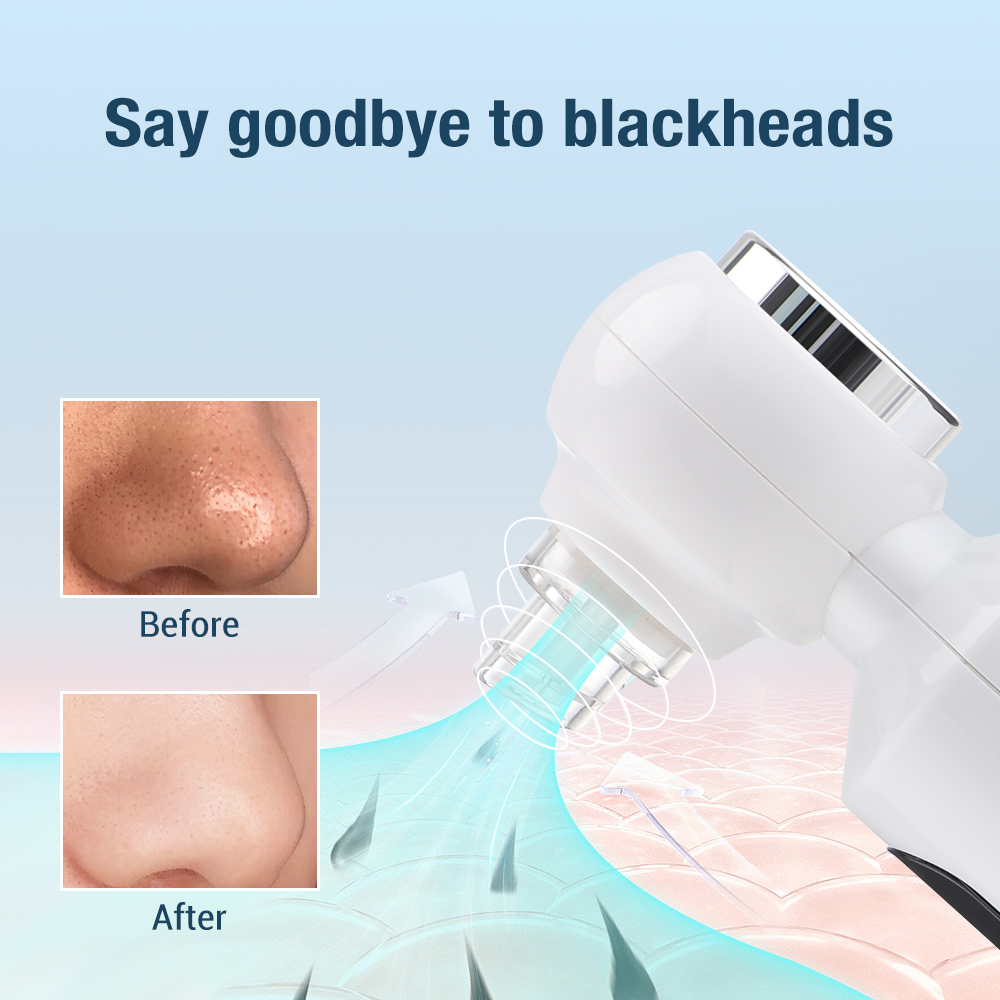 Electric Bubble Blackhead Remover Pore Vacuum Face Cleaner Hot Compress Black Dots Extractor Blue Light Sterilization Skin Care Facial Cleaning Device