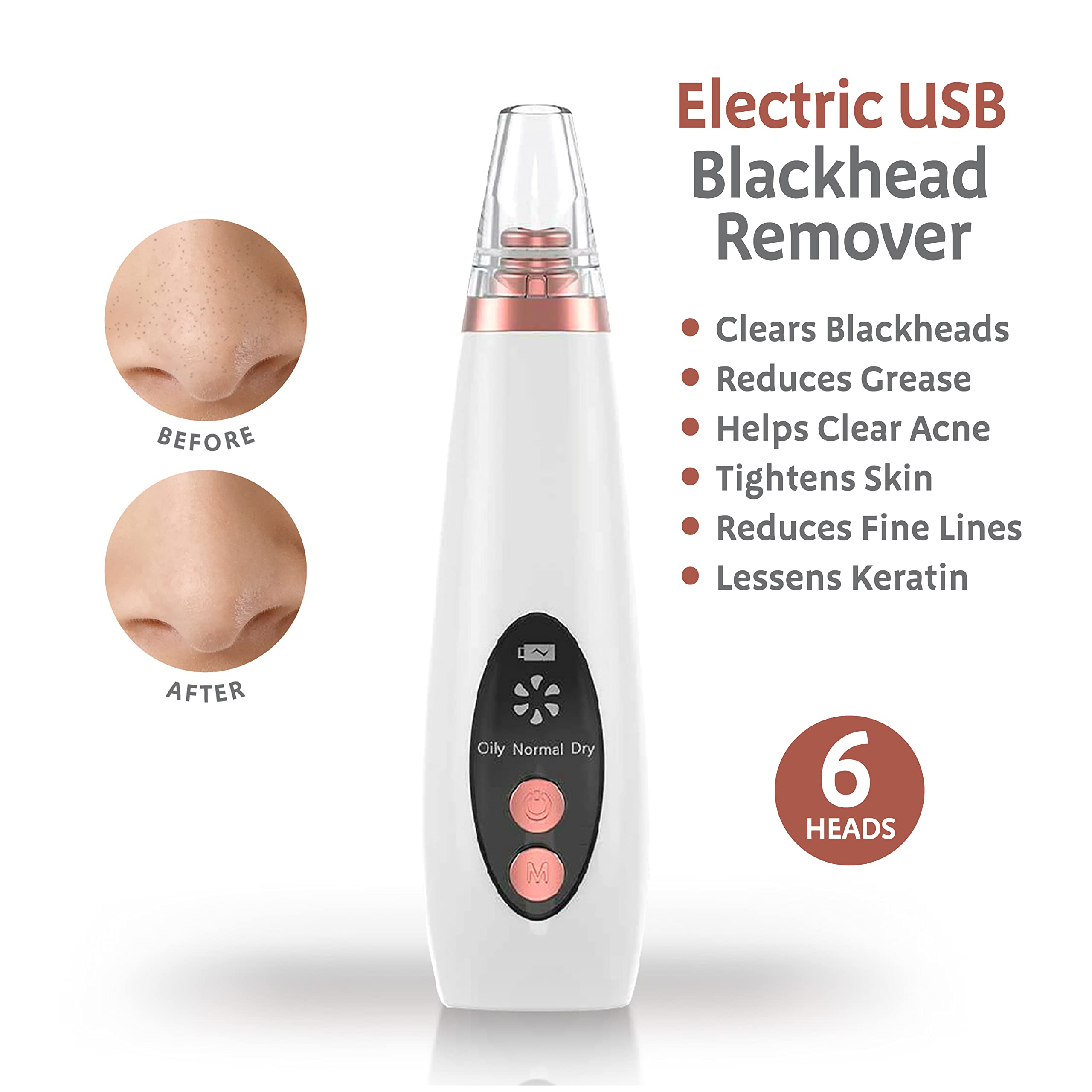 Blackhead Remover Acne Cleaner Vacuum Pore Suction Tools Electric USB Rechargeable Face Skin Black White Head Spot Zit Grease