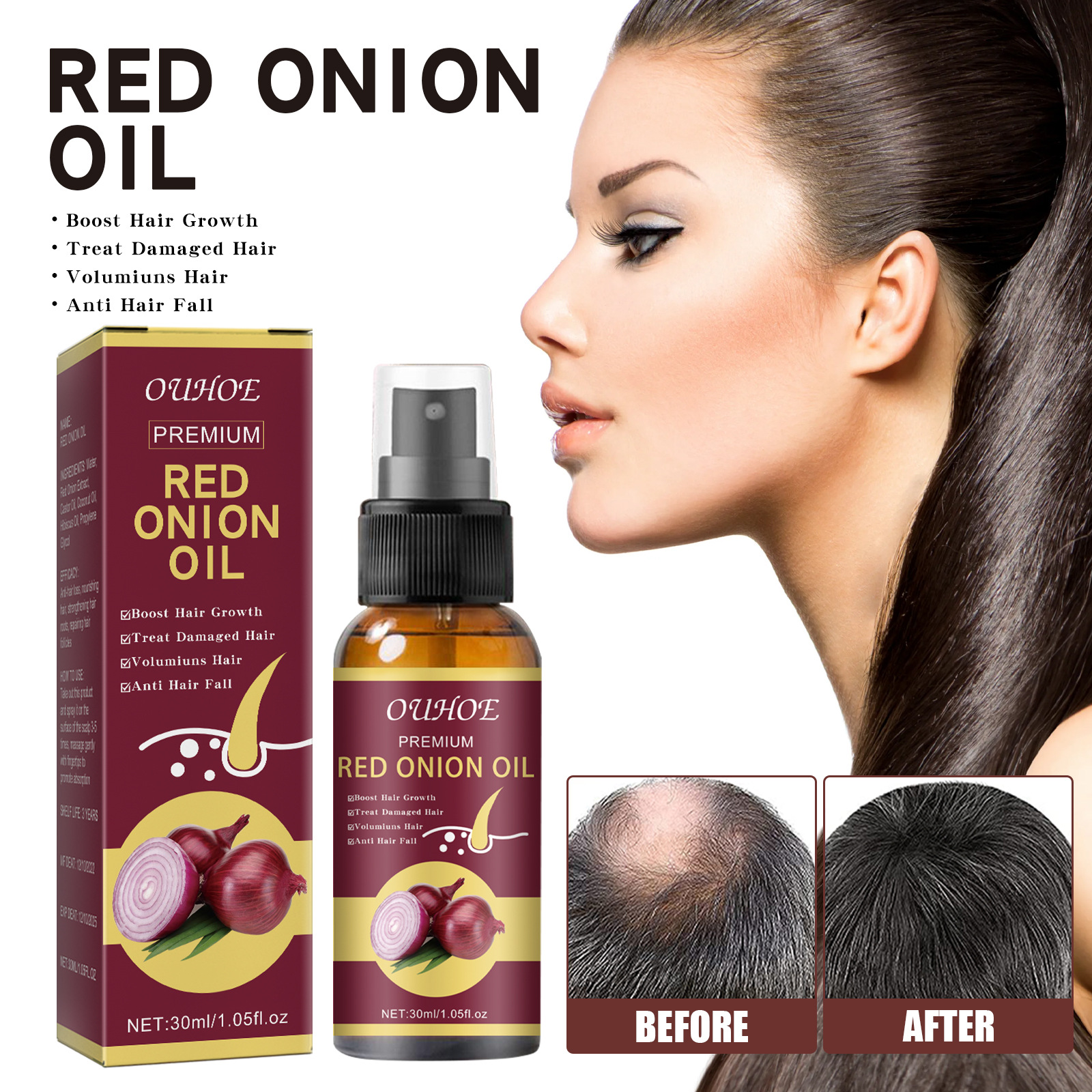 Onion Hair Thickening Spray Hair Anti-Loss Spray For Improving Scalp Circulation Stimulating Hair Growth Strengthening Home Use 30ml