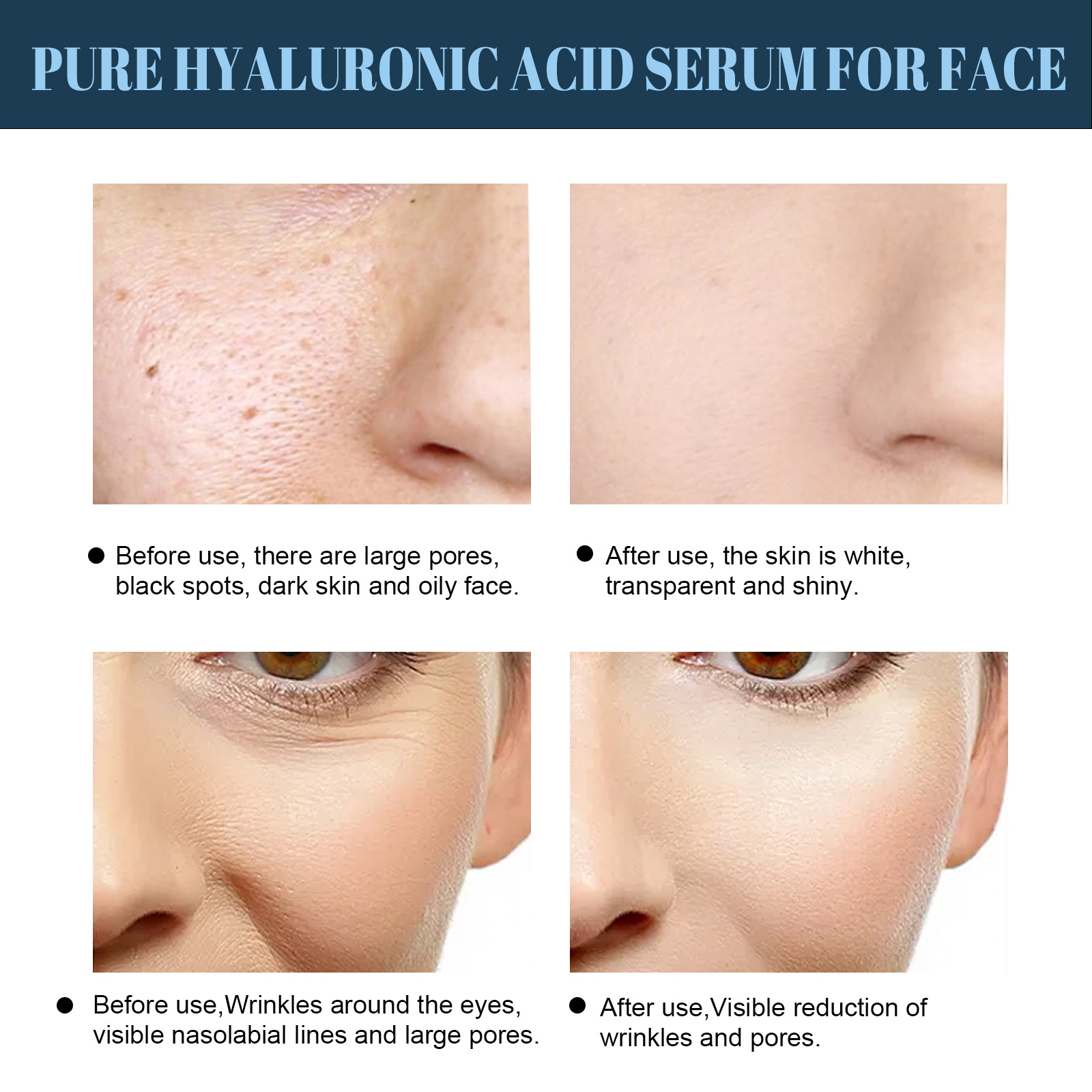 Protein Thread Lifting Face Filler Protein Line Hydrolyzed Collagen Absorbable Smoothing Firming Moisturizing Tightening Anti-wrinkle