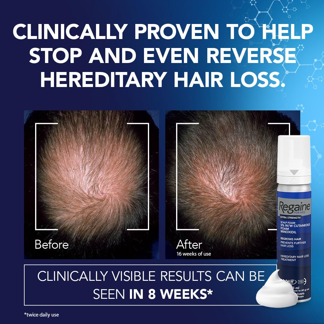 Regaine Extra Strength Scalp Cutaneous Foam 3x 73 ml Treatment for Regrowth in Men with 5 Percent Minoxidil for Male Hair Loss