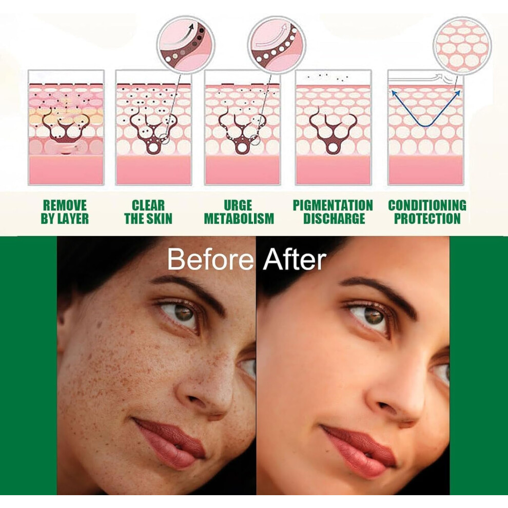 AXIS-Y Dark Spot Correcting Glow Serum 50ml Brightening Serum Korean Skincare Dark Spot Treatment Hyperpigmentation Treatment