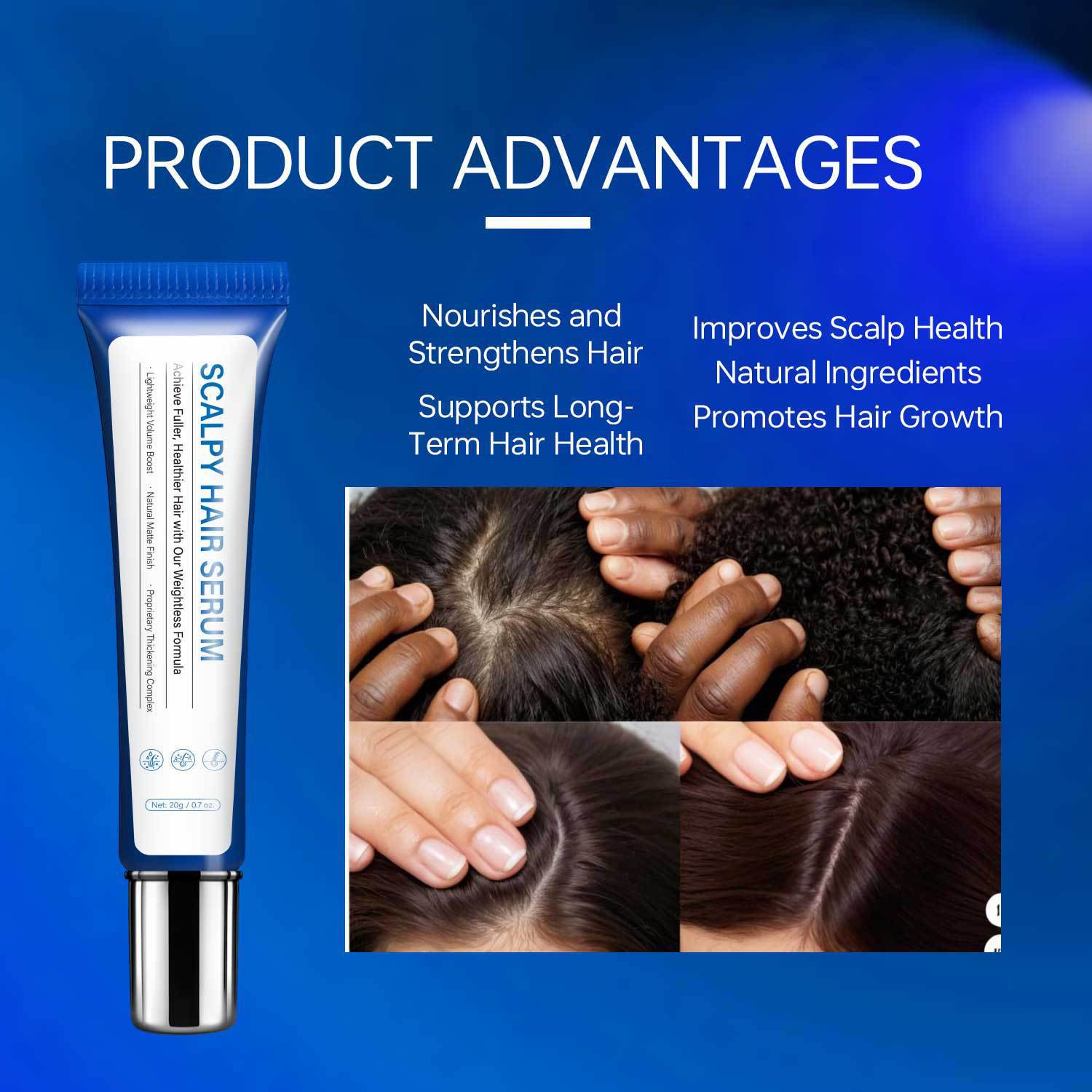 Scalp Hair Serum Nourishing Strengthening Revitalizing For Dry Scalp Thinning Hair Daily Root And Follicle Care Treatment 20g