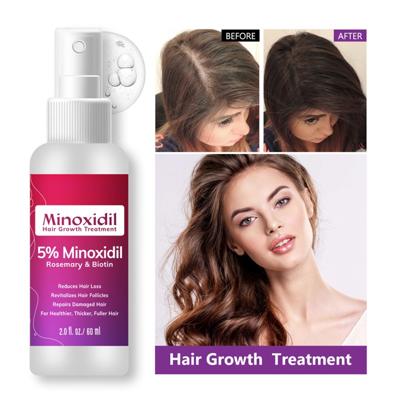 2PCS 60ML Minoxidil 5% Rosemary and Biotin Hair Spray Hair Growth Spray