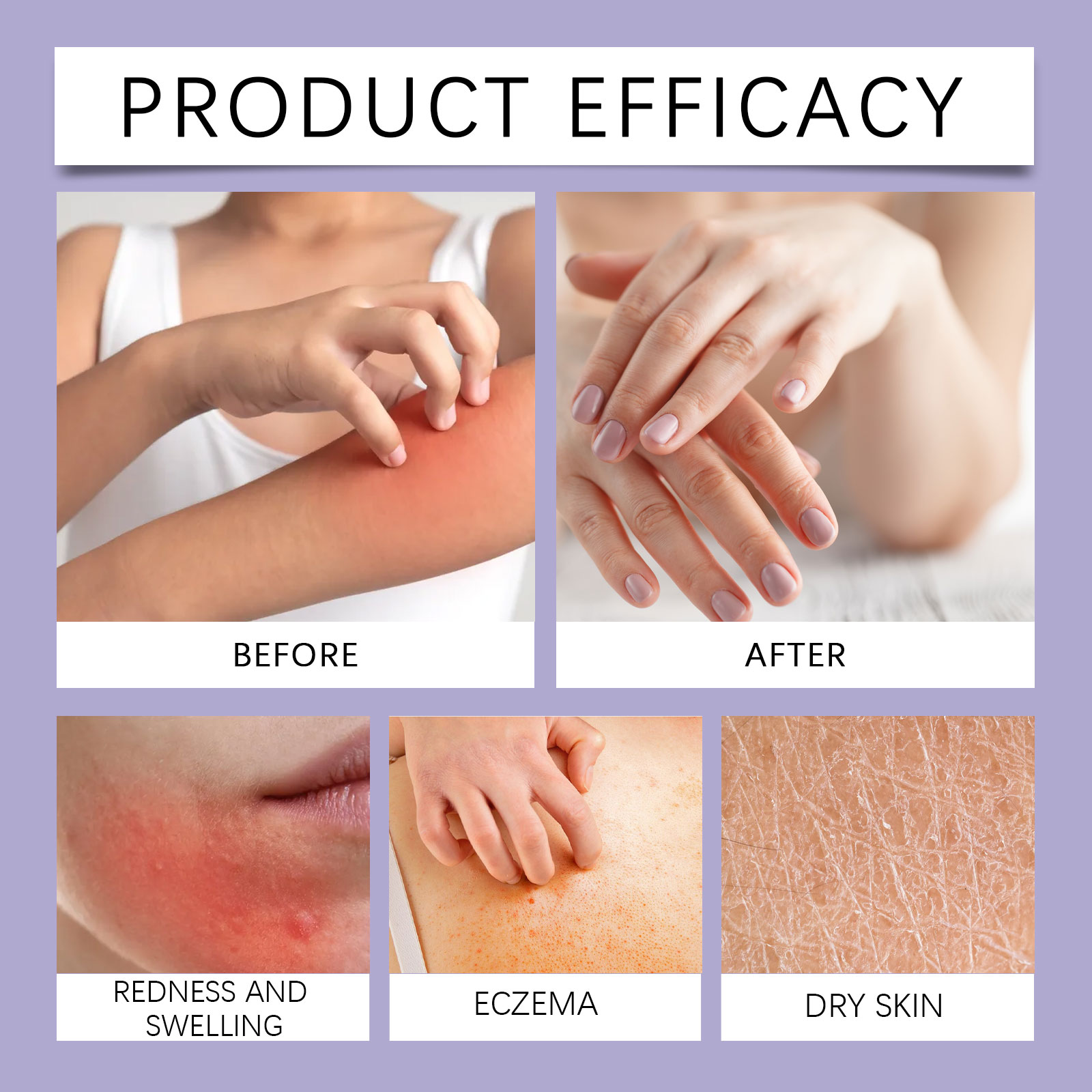 Skin Smoothing Care Patch Salicylic Acid Mild Clean Hand Foot Body Skin Gentle Moisturizing Smooth Rejuvenating