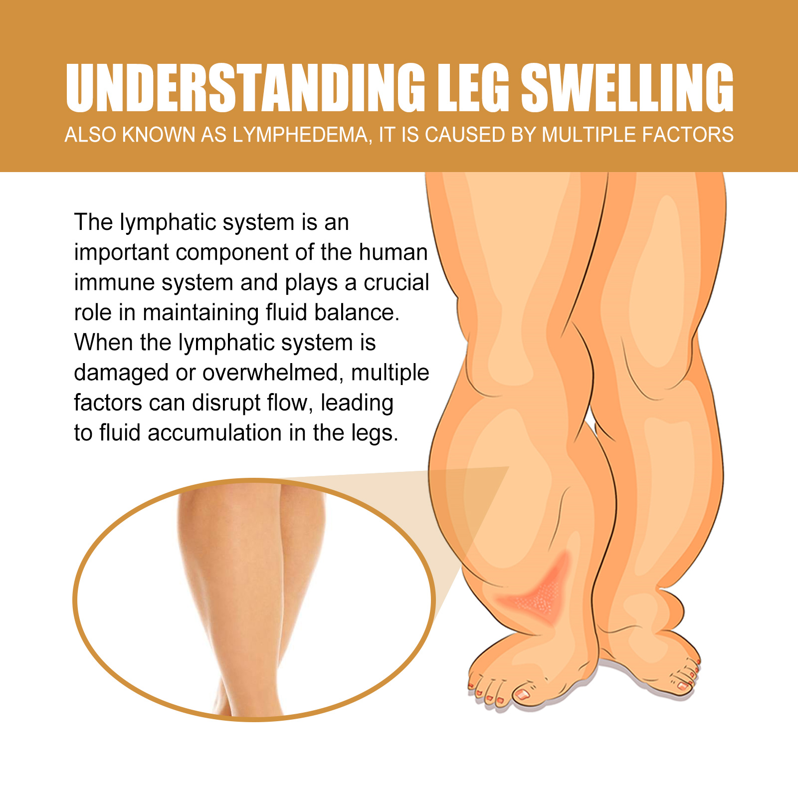4PCS Anti-Swelling Slimming Oil Swellclear Massage Oil For Legs and Feet