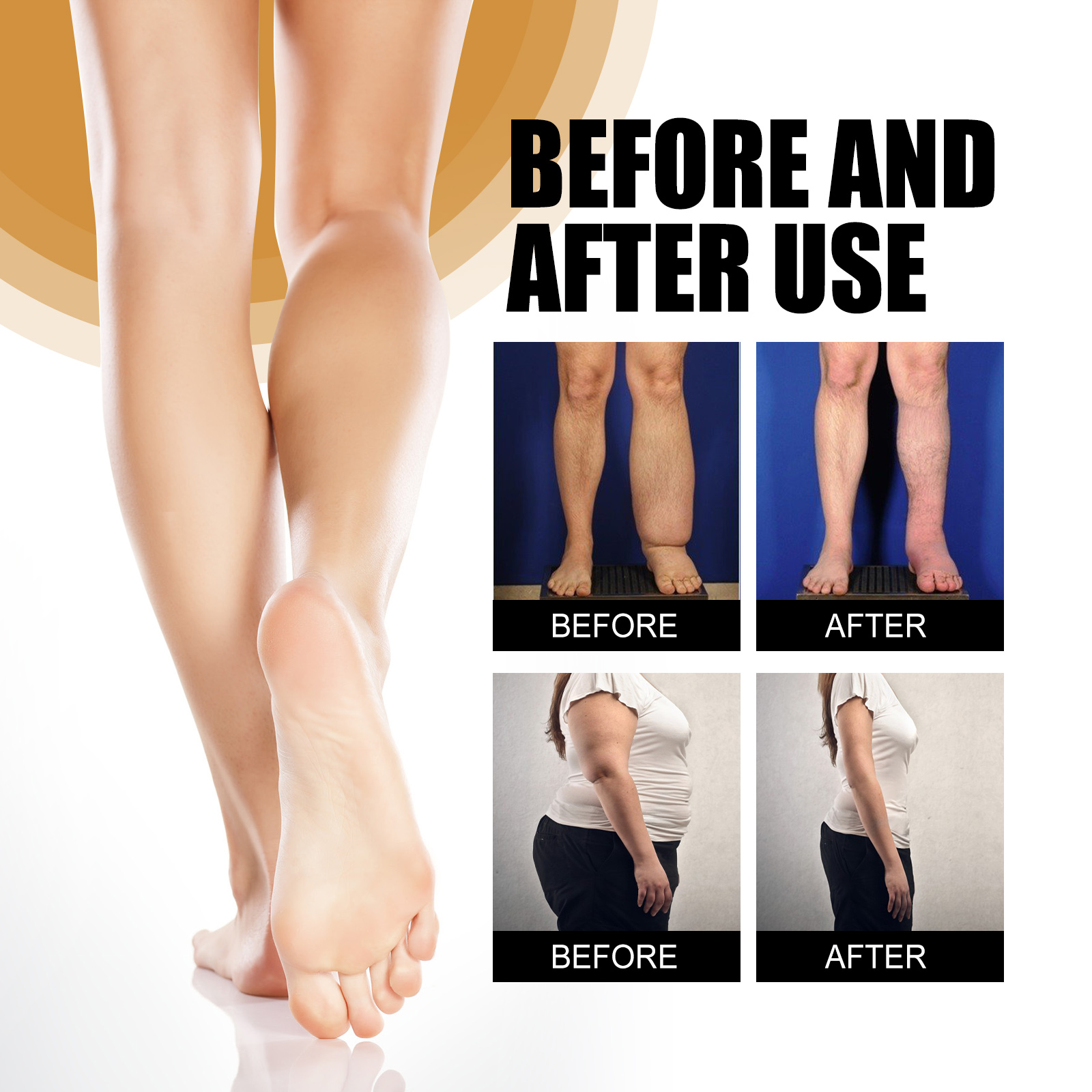 4PCS Anti-Swelling Slimming Oil Swellclear Massage Oil For Legs and Feet
