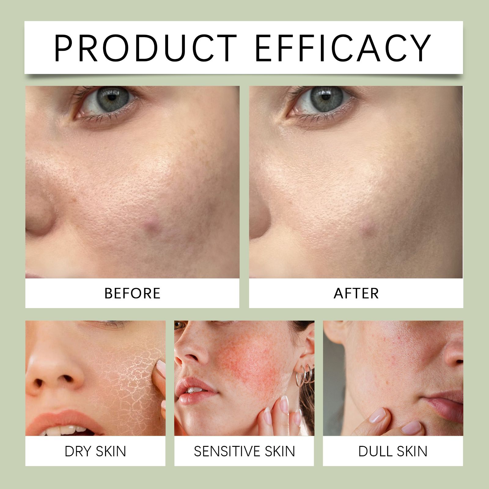 Centella Repair Essence Hydrating Nourishing For Daily Facial Skin Care