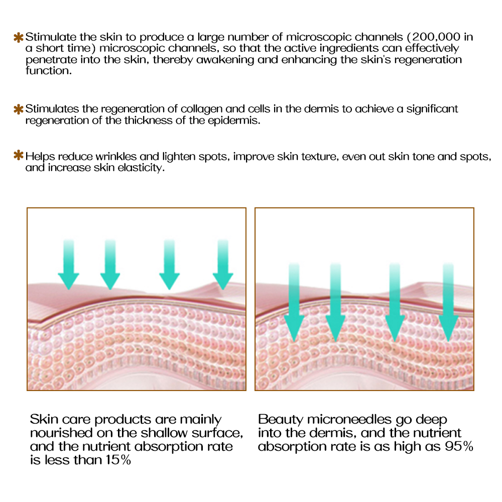 (0.2mm) Microneedle GTS 192 Derma Roller Hair and Scalp Roller  Facial Skin CareTool for Dormant Scalp Follicles Stimulates Healthy Hair Growth Suitable for Men and Women