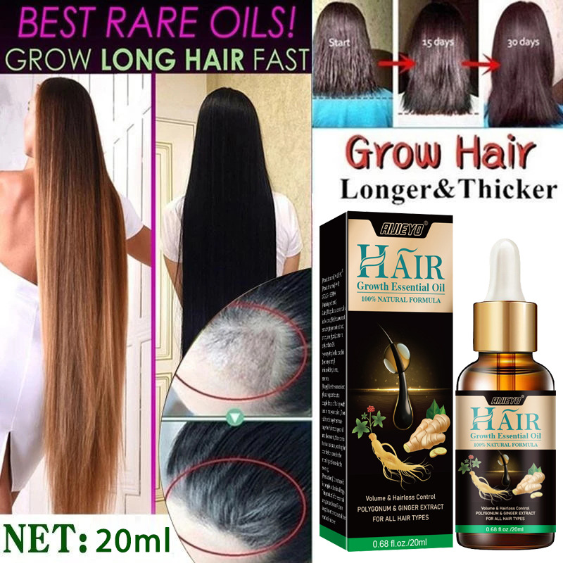 Hair Growth Essential Oil Ginger Hair Lost Solution Serums Fast Scalp Hair Care Treatment For Men Women 20ml