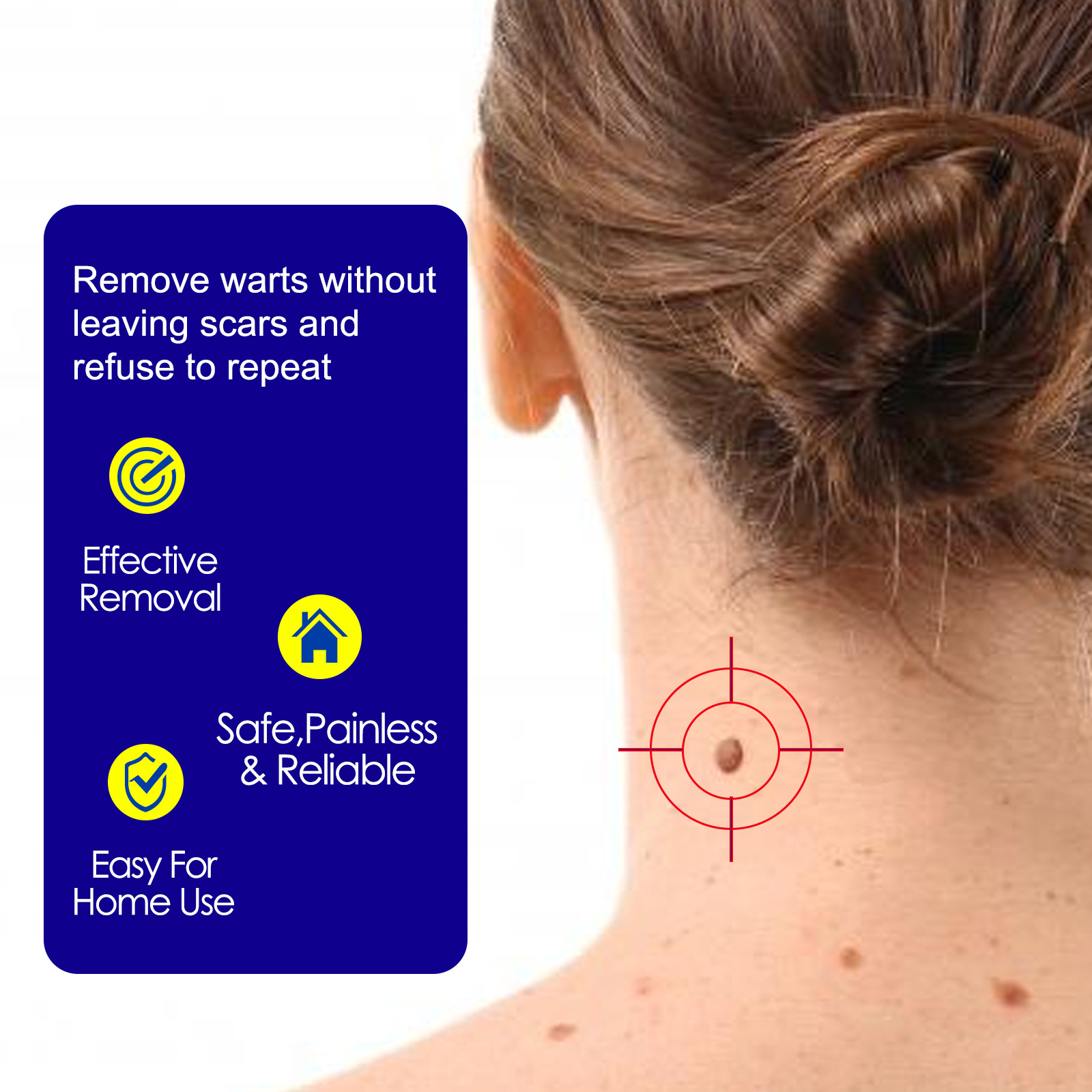 Ouhoe Skin Tag Remover Warts Remover Ointment Mole Remover Cream Mole Corrector Safe Painless Remove Skin Tag Callus Skin Treatment Ointmen