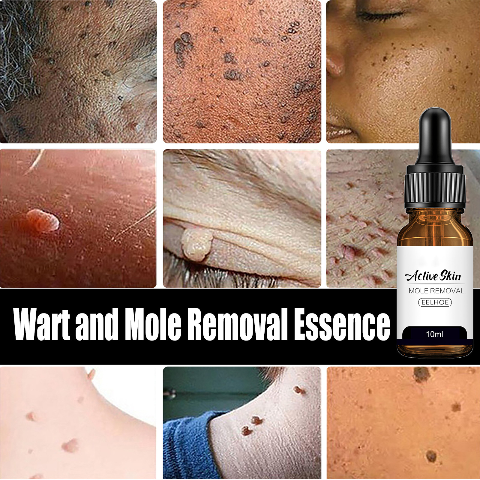 EELHOE Aclive Skin Mole Removal Essence