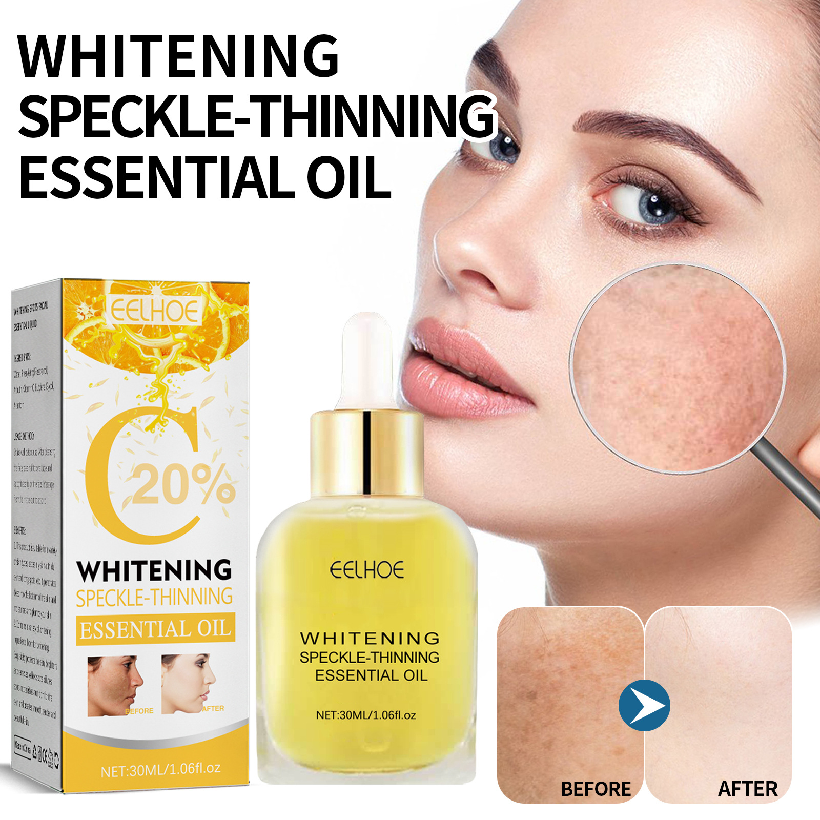 Vitamin C Whitening Freckles Serum Face Essence Remove Dark Spots Freckles Fade Melanin Nicotinamide Essence Brighten Lighten Moisturizing Facial Serum