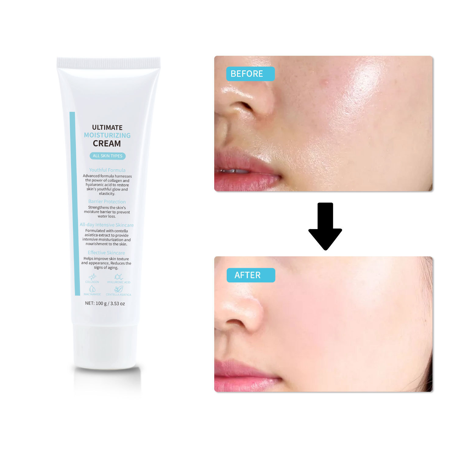 Youth Formula Ultimate Moisturizing Cream Niacinamide Collagen Sodium Hyaluronate Centella For Deep Hydration Firming And Daily Anti Aging Face Care 100g