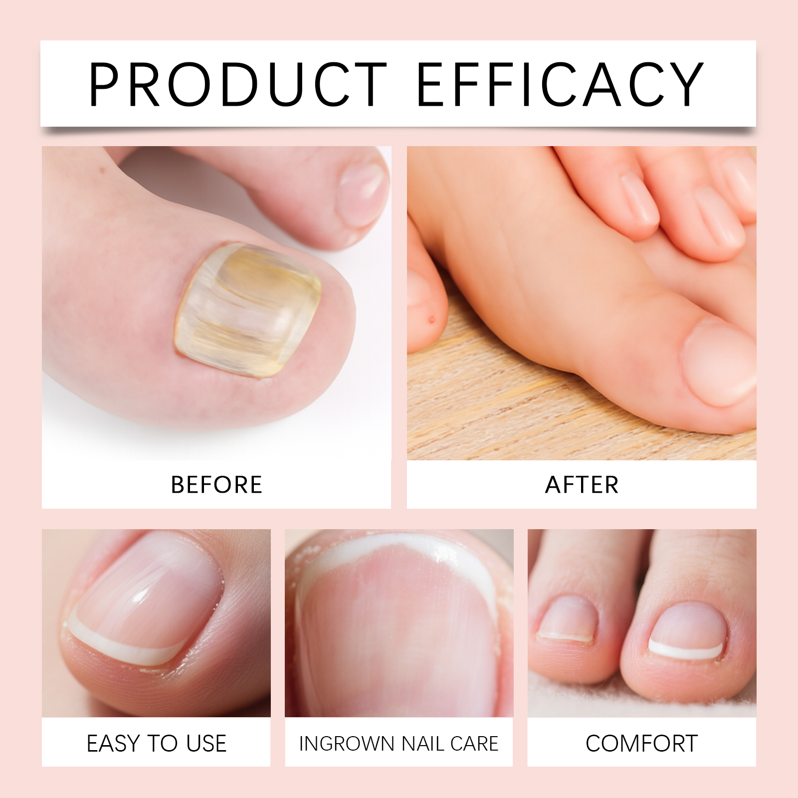 Nail Care Drop Gentle Nourish Clean Brighten Nail Surface Hand Foot Daily Maintenance Essence