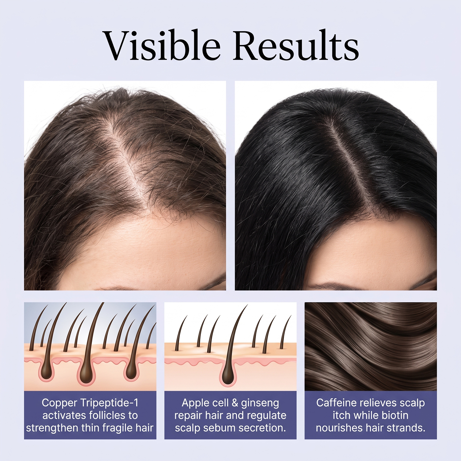 Hair Nourishing Care Roller Root Strengthening Smoothing Balancing Soft Portable Rolling Massager