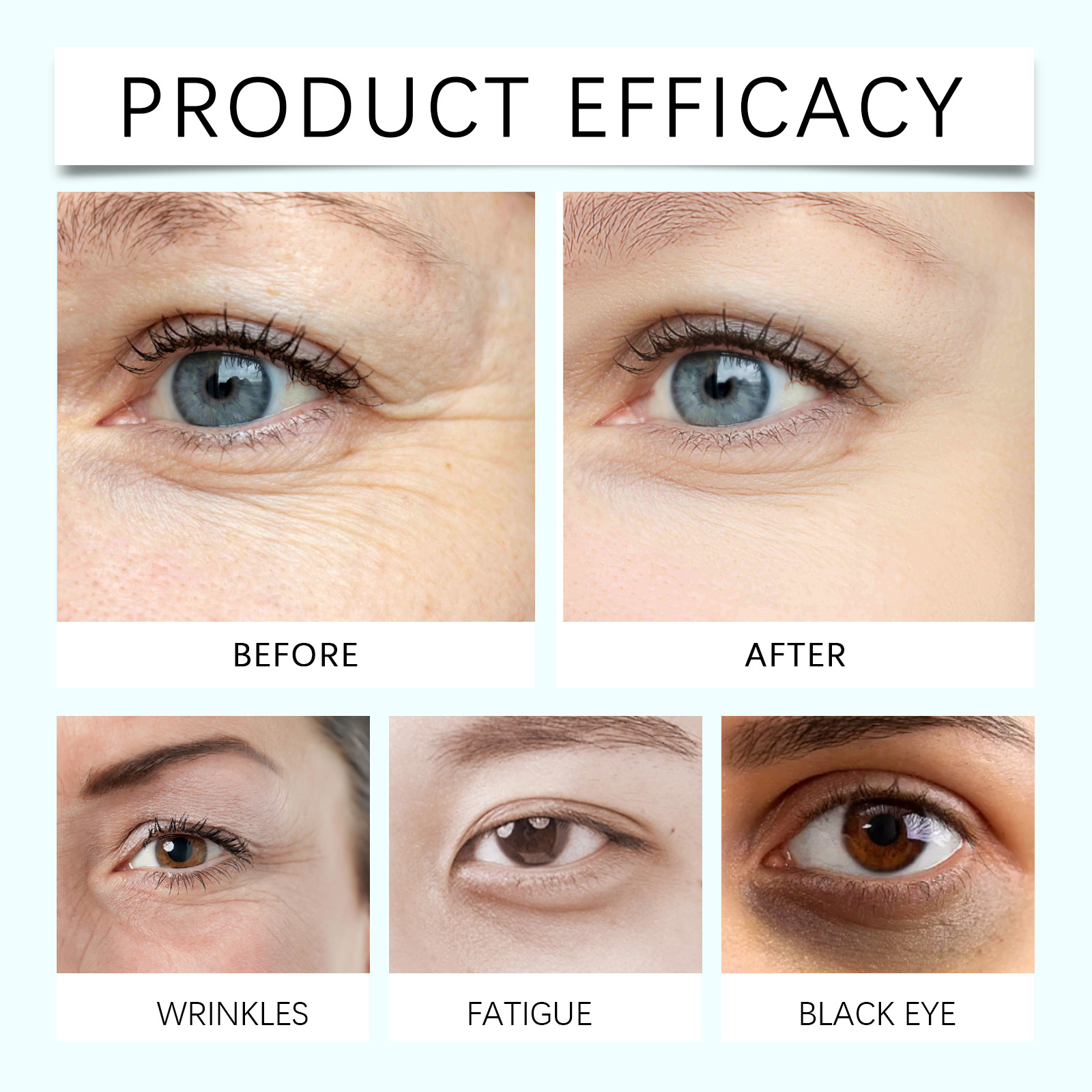 Polypeptide Eye Essence Containing Botanical Extract Mild Hydrating Moisturizing Soft Nourishing Periorbital Skin Care Liquid