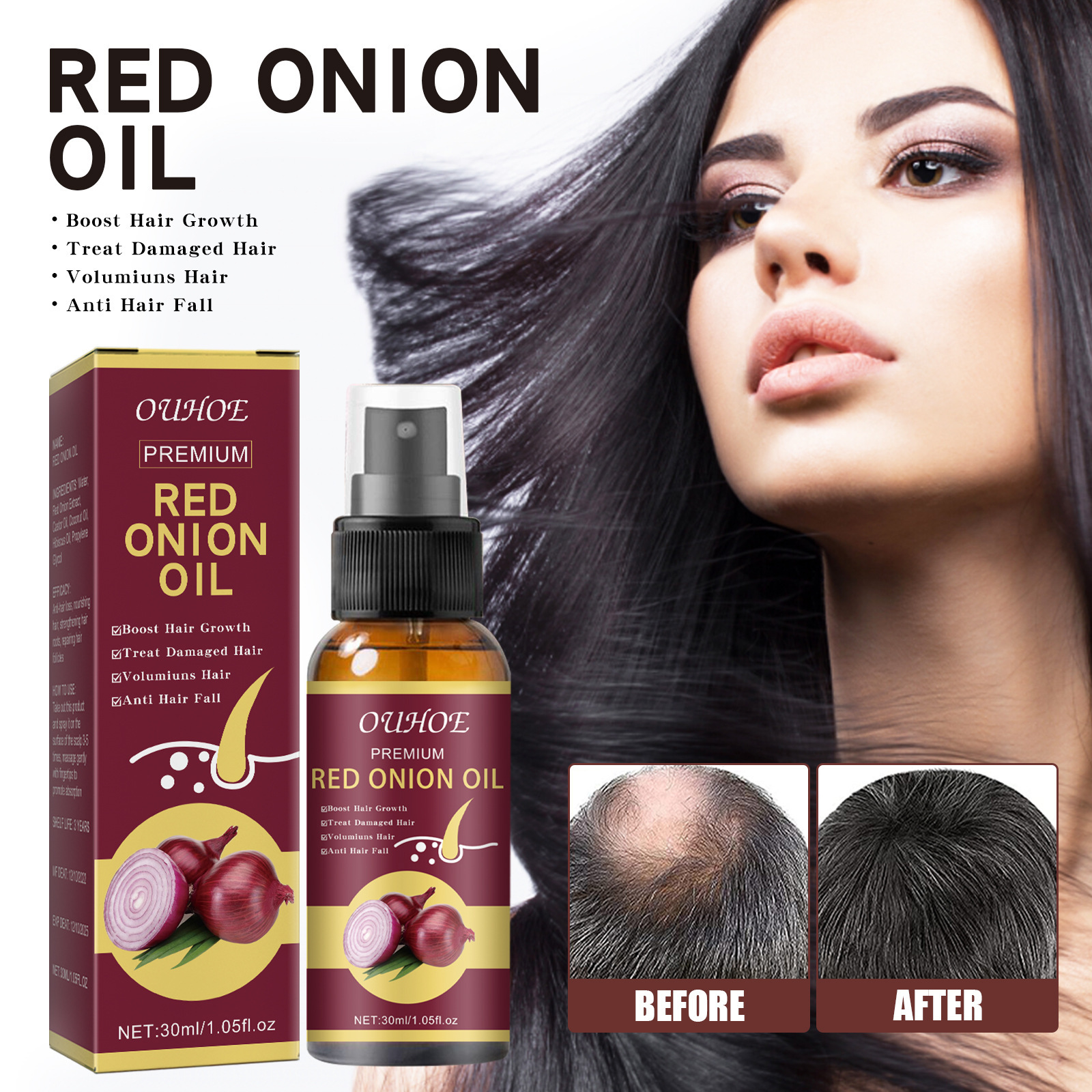Onion Hair Thickening Spray Hair Anti-Loss Spray For Improving Scalp Circulation Stimulating Hair Growth Strengthening Home Use 30ml