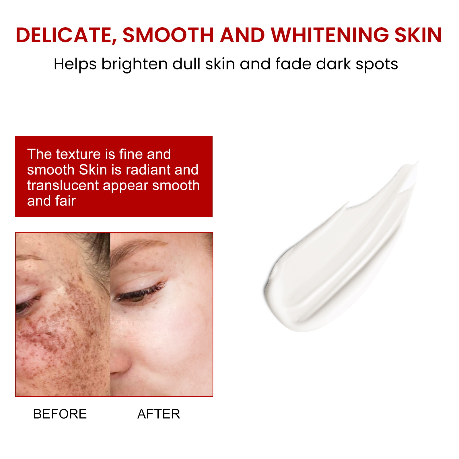 Whitening and Freckle Removing Cream Remove  Dark Spot Melanin Melasma Lighten Brighten Smooth Skin Care