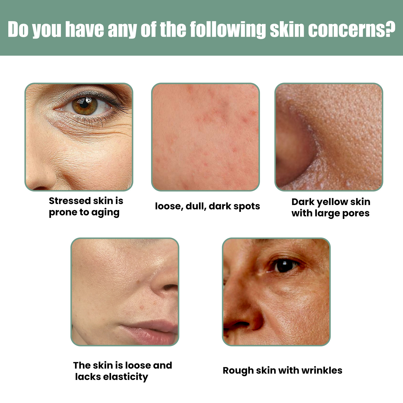 Collagen Skin Essence Anti Dark Spots Serum Fade Fine Lines Remove Wrinkles Improve Dry Skin Moisturiz Smooth Skin Anti Aging Hydrates Skin Care 30ml
