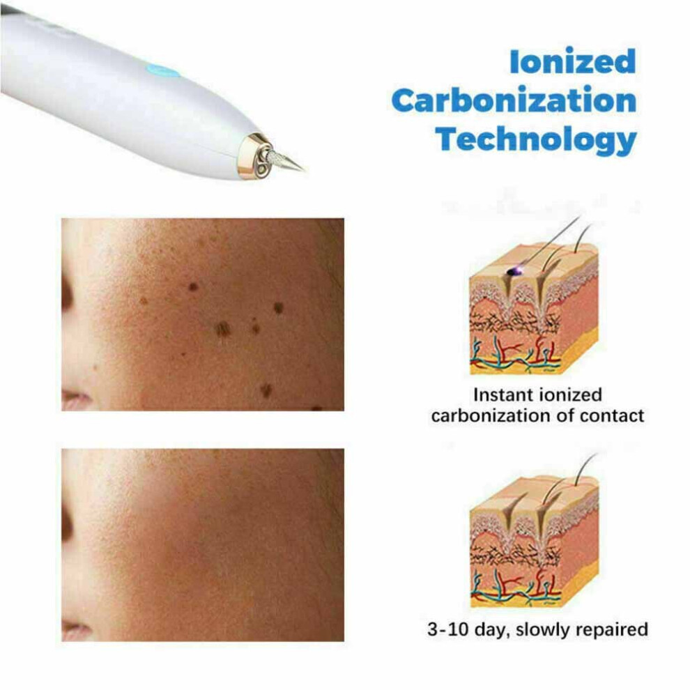 Laser Plasma Pen Mole Removal Dark Spot Skin Tag Tattoo Mole Wart Remover Pen