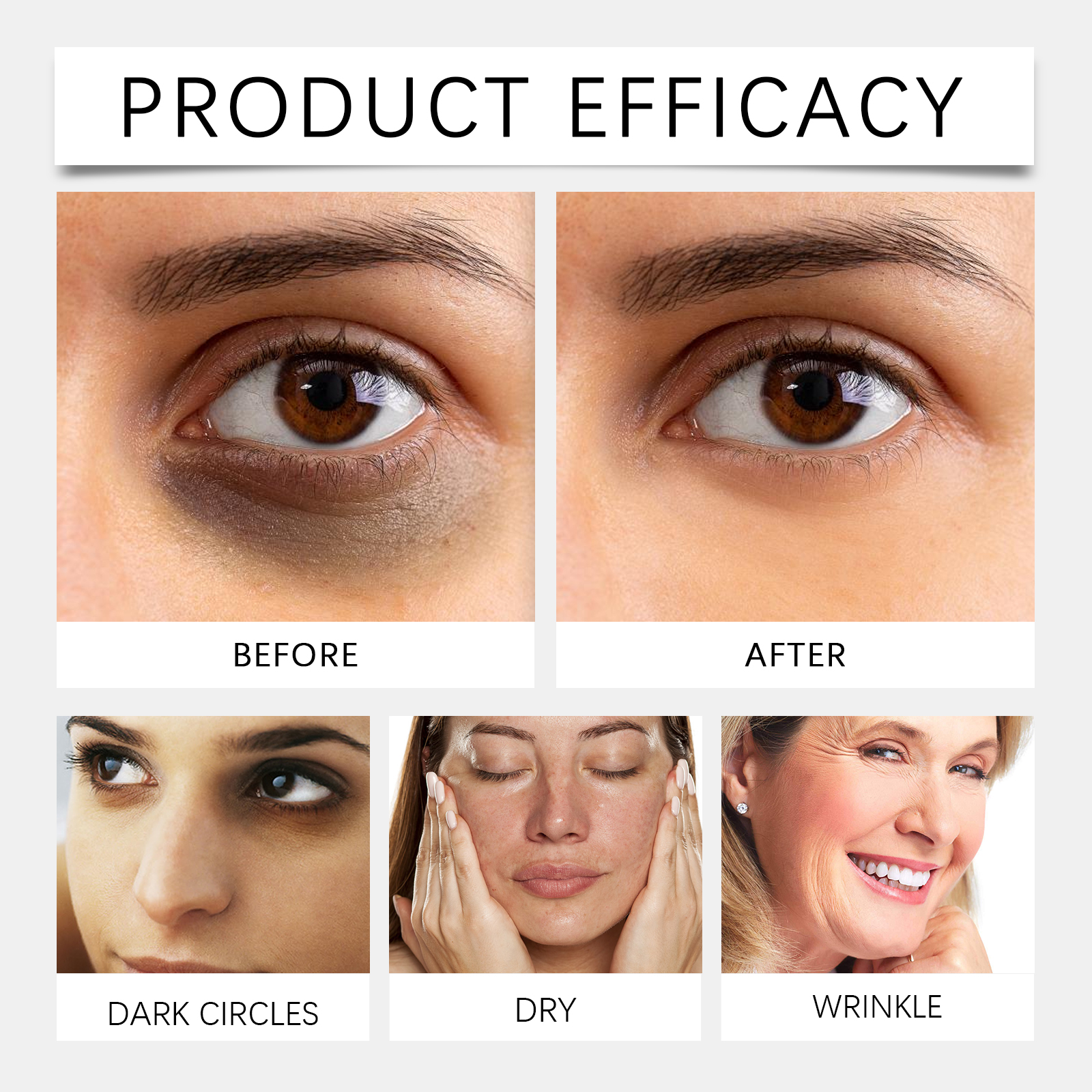 Retinol Eye Cream Fades Fine Lines Tightens Skin Mildly Nourishes Hydrates Softens Daily Eye Care
