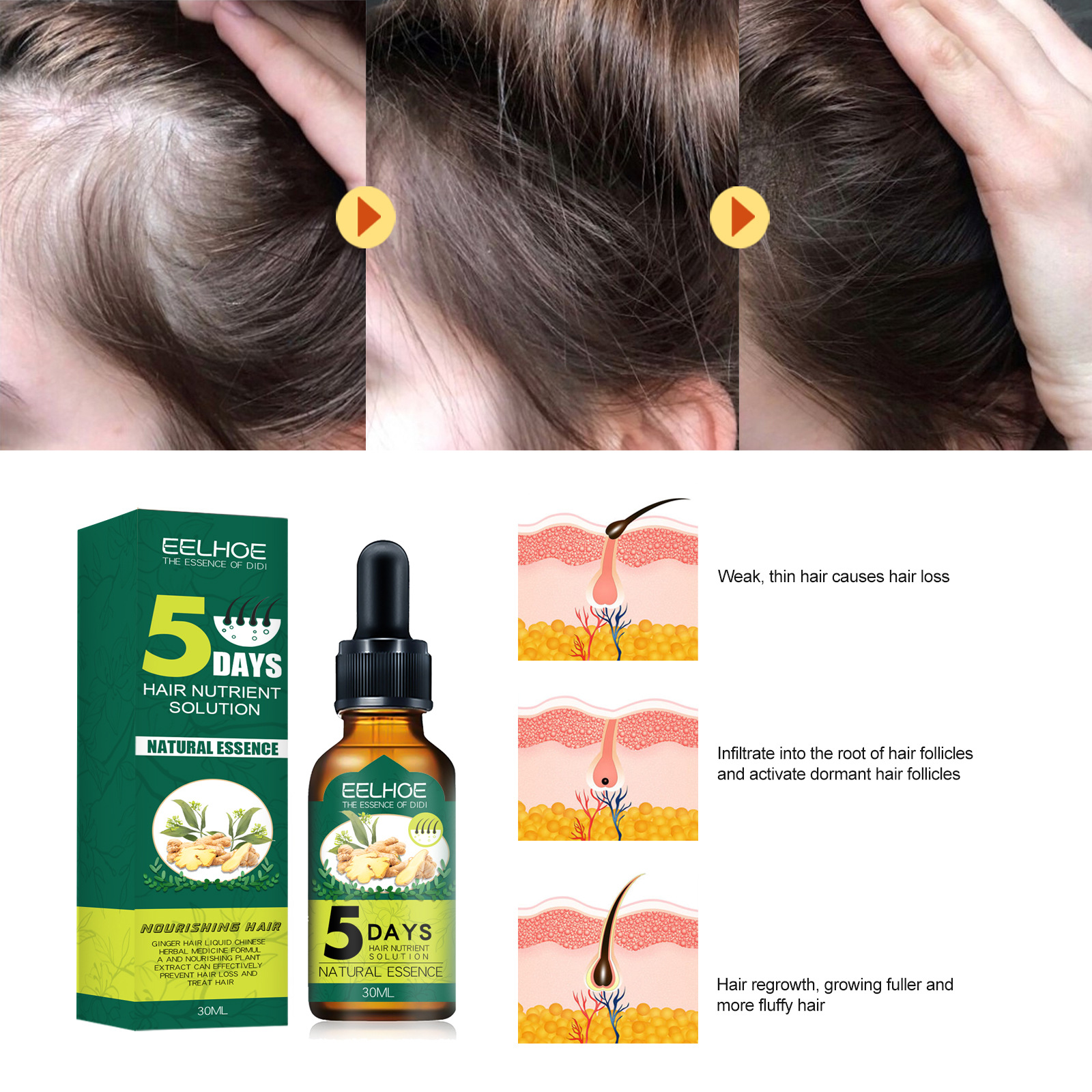 Ginger Hair Care Essential Oil Hair Growth Liquid Anti Hair Loss Serum 5 Days Nutural Solution Treat 30ml