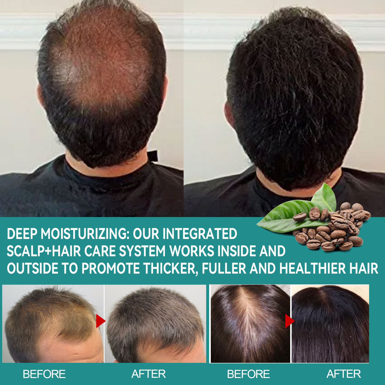 Hair Growth Essential Oil Hair Growth Oil for  Hair Fixing And Density Increasin Strong Hair Stop Thinning and Hair Loss