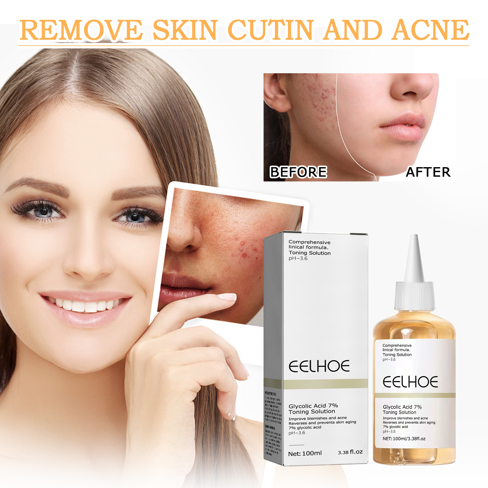 Face Toner for Women Glycolic Acid 7 Percent Toning Resurfacing Solution Improve Blemishes Remove Acne Marks Skin Care