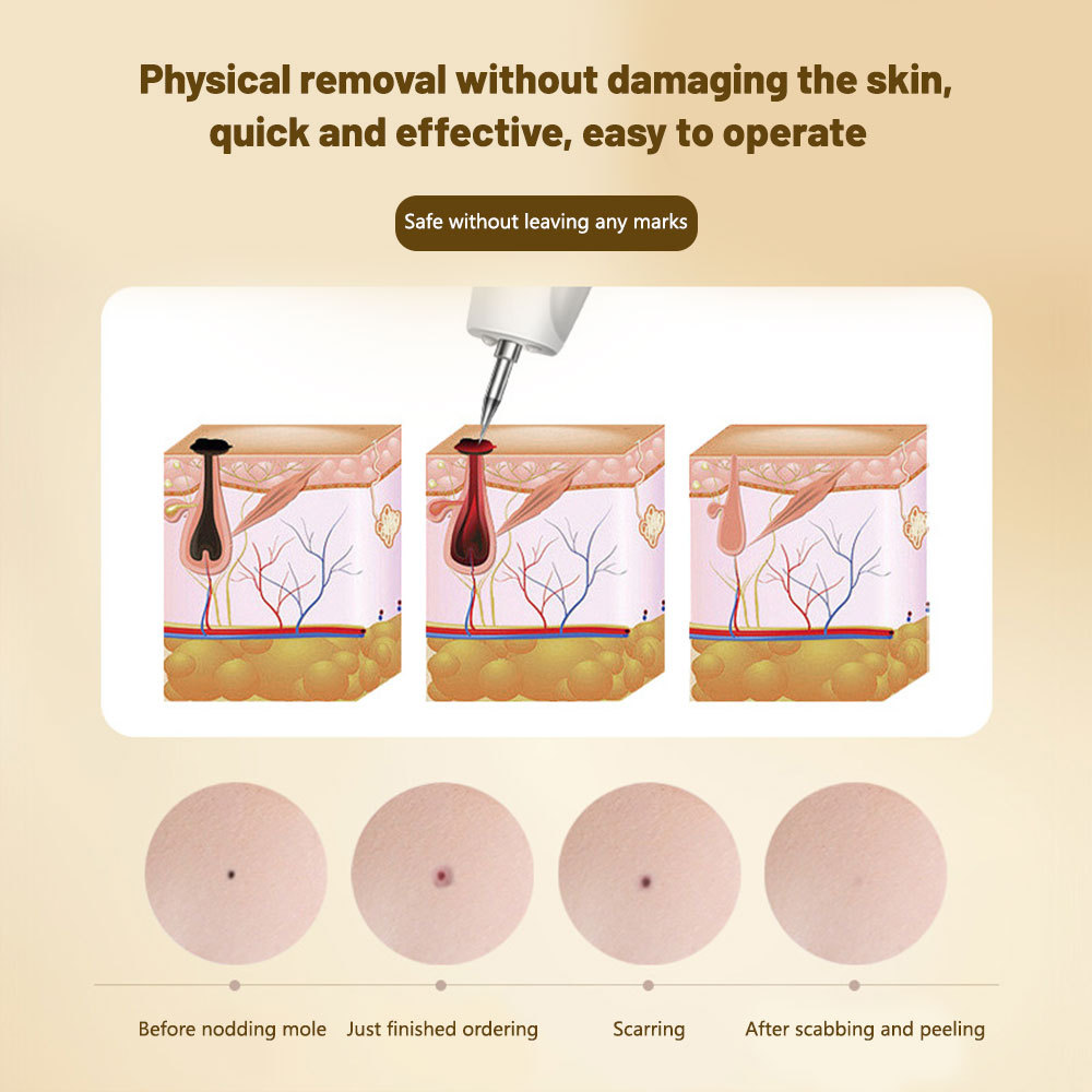 Freckle Dark Spot Mole Pen Blue Light Ionized Carbonization Repair Electric Salon Special Remove Skin Tag Fat Grain Warts Berrugas Eliminator Plasma Pen